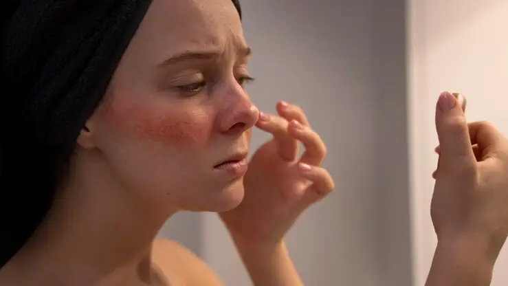 Setembro Amarelo: entenda como o impacto das emoções afeta a saúde da pele e cabelo; especialista comenta sobre reações