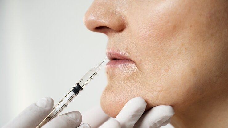 Especialista alerta sobre os riscos do uso de botox falso e orienta cuidados para evitar complicações