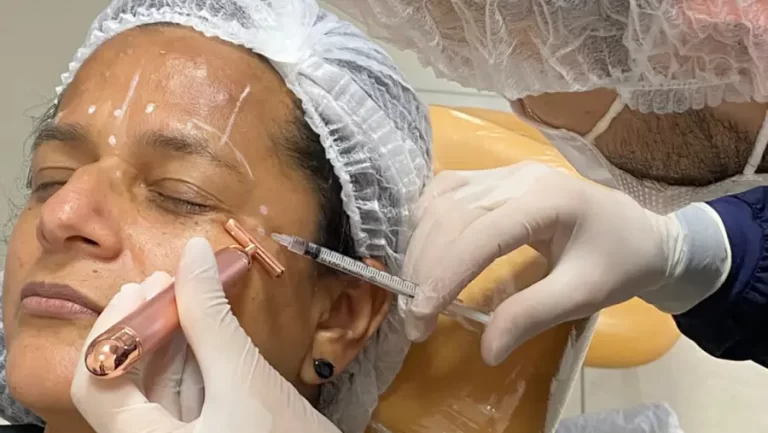 Botox Preventivo: Prevenção e Naturalidade com Dr. Nélio Novaes